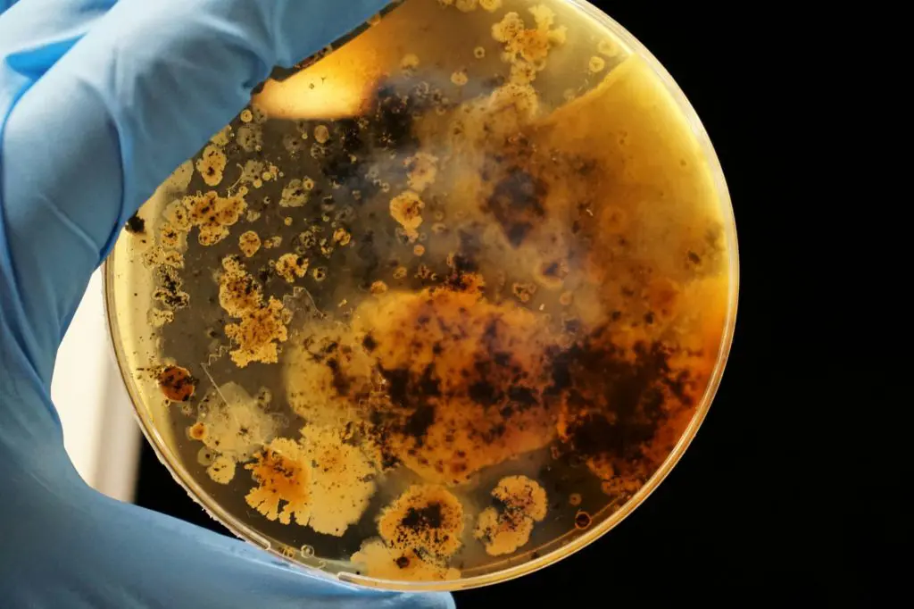 Bacteria in a petri dish