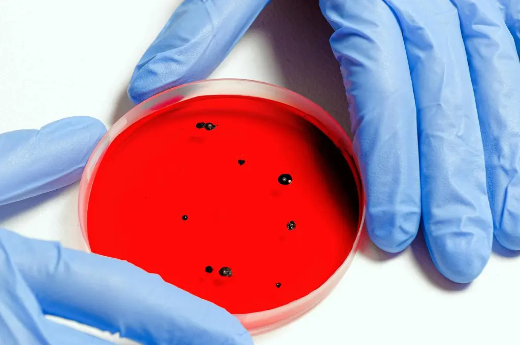 Petri dish full of a disease